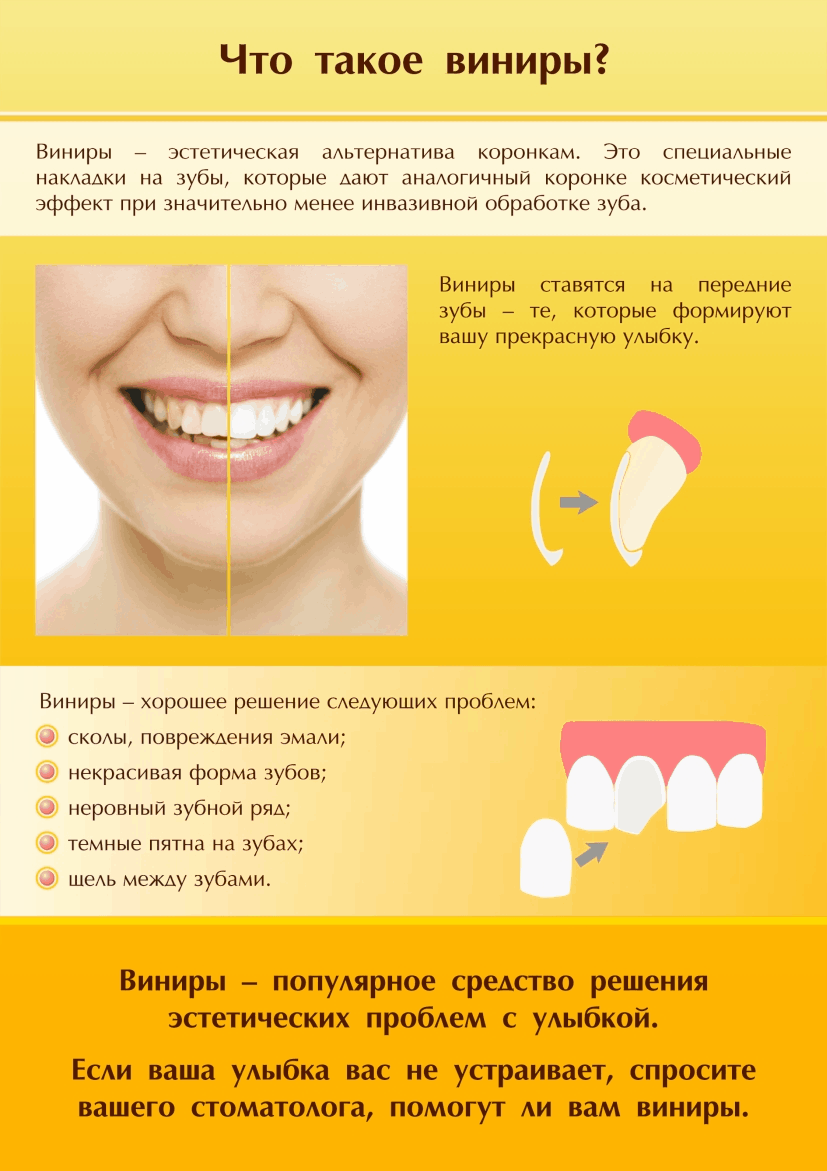 Причины некрасивой улыбки и методы исправления