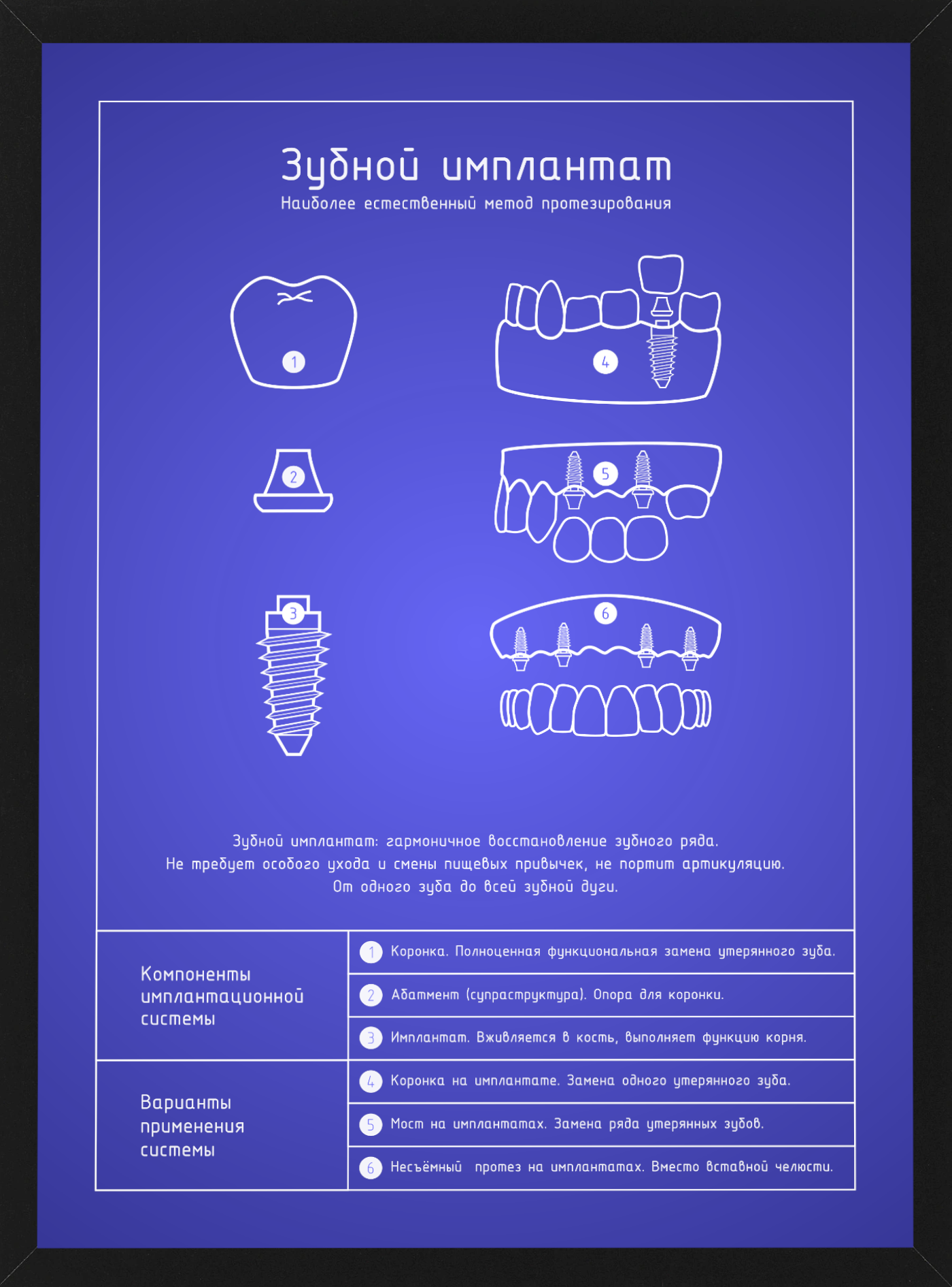 Магазин имплант. Плакат стоматолога. Стоматологические импланты плакат. Постеры в стоматологию. Плакаты для стоматологического кабинета.