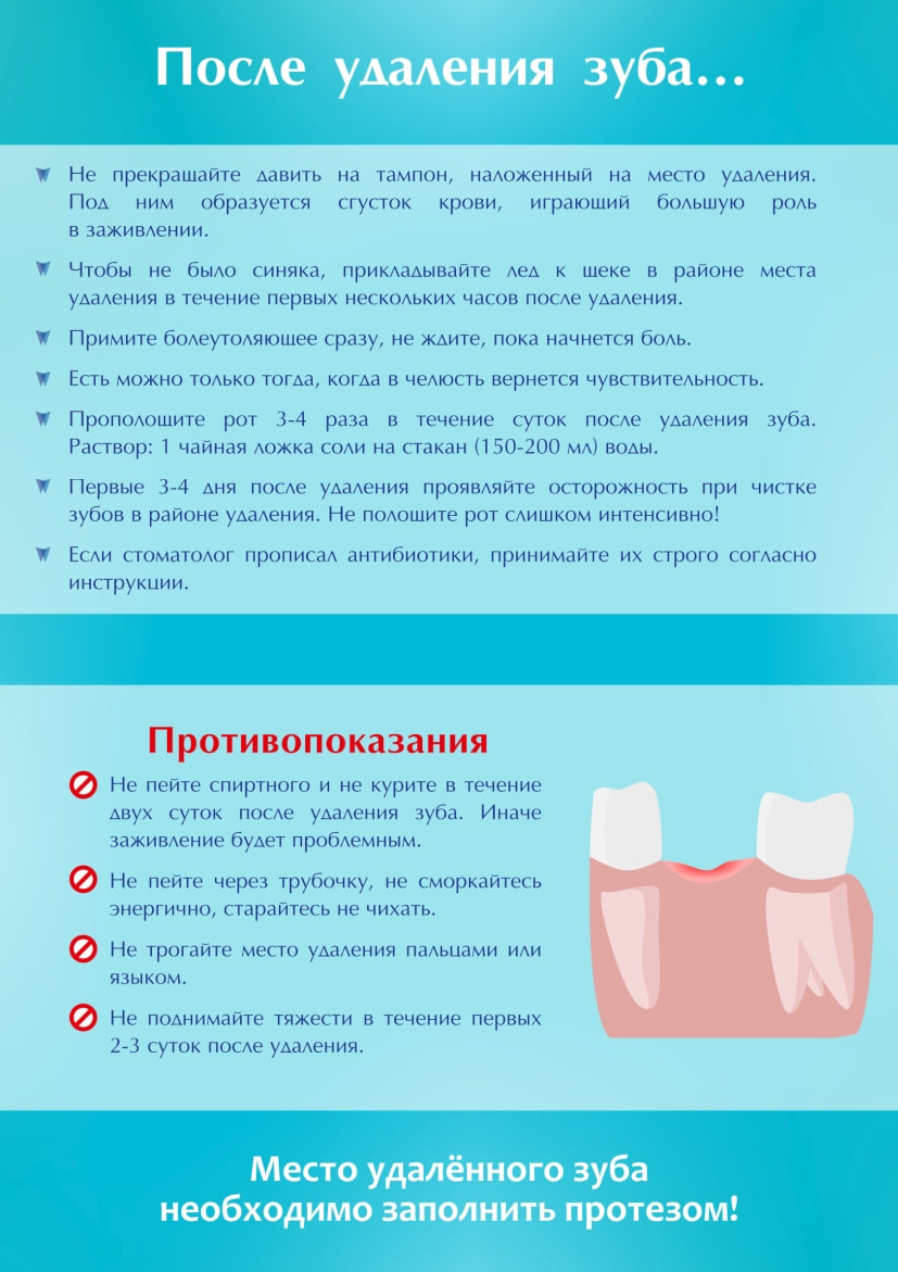 Вам удалили зуб: рекомендации по уходу за ротовой полостью